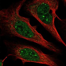 ZCCHC12 Antibody, Novus Biologicals 0.1mL; Unlabeled:Antibodies, Polyclonal